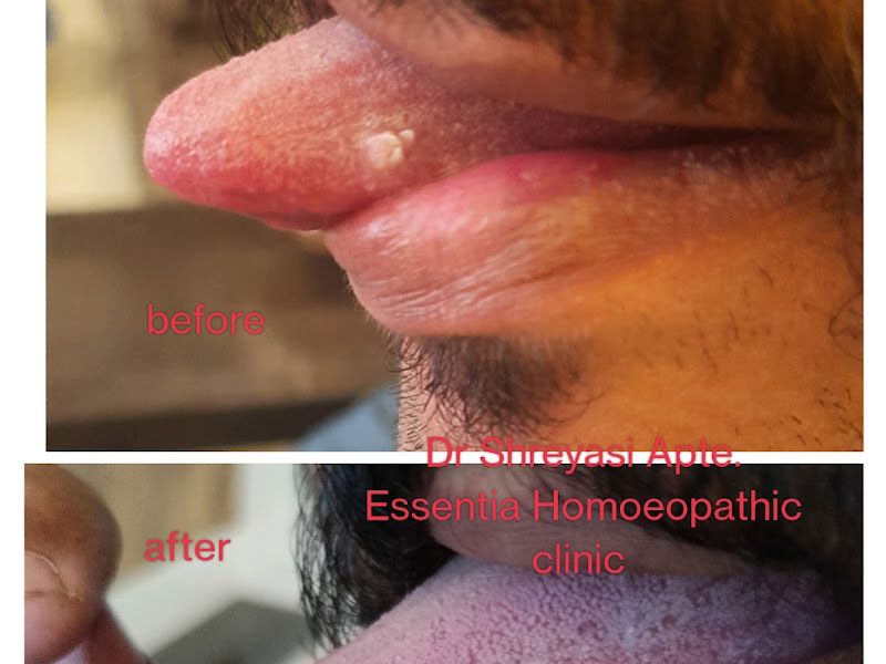Gallery — Dr. Shreyasi Apte's Essentia Homoeopathic Clinic, Pune