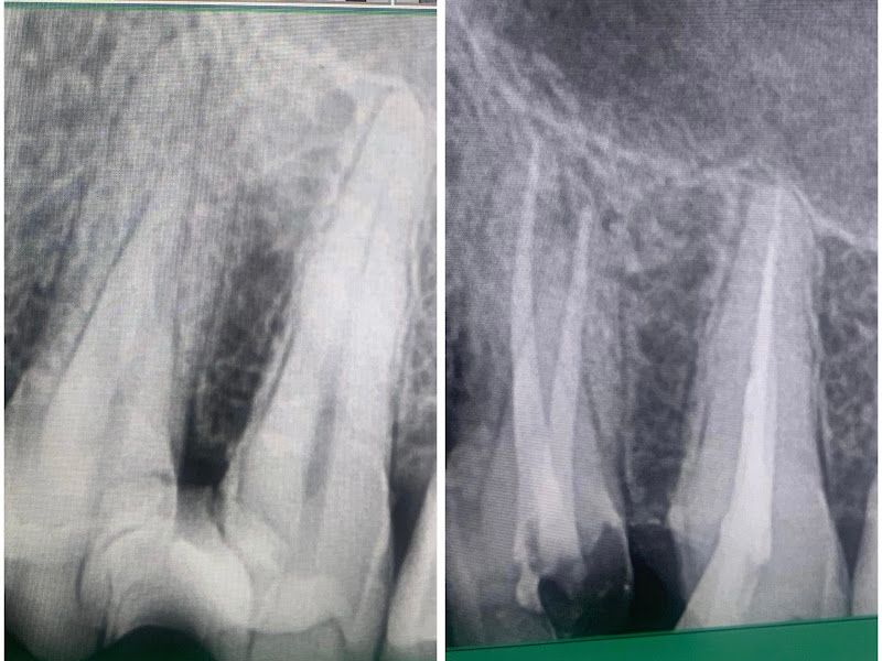 Gallery — Dr. Wani's Multispeciality Dental Clinic, Thane (West)