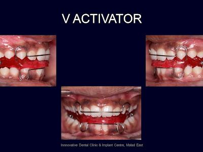 Innovative Dental Clinic and Implant Centre — Dental clinic in Mumbai