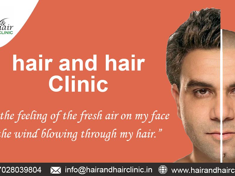 Gallery — Hair And Hair Clinic, Pune