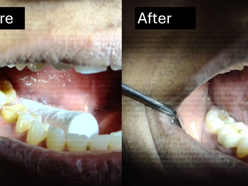 Gallery — Dr Pote's Dental Clinic, Dombivli East