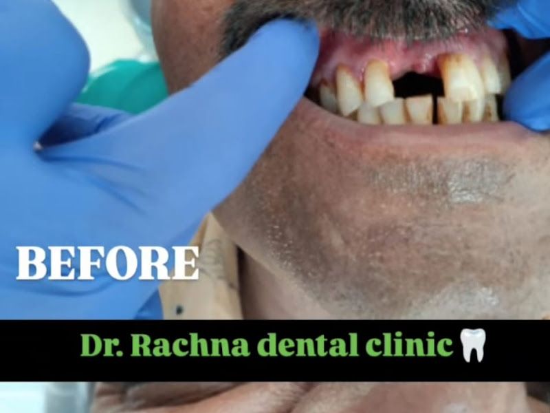 Gallery — Dr. Rachna's Dental Clinic, Pune