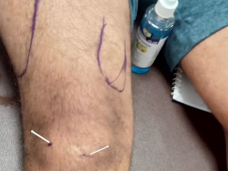 Gallery — Dr. John's Physiotherapy Centre, Thane West