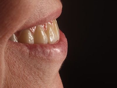 Dr Hemang Sheth Dental Clinic — Dentist in Mumbai