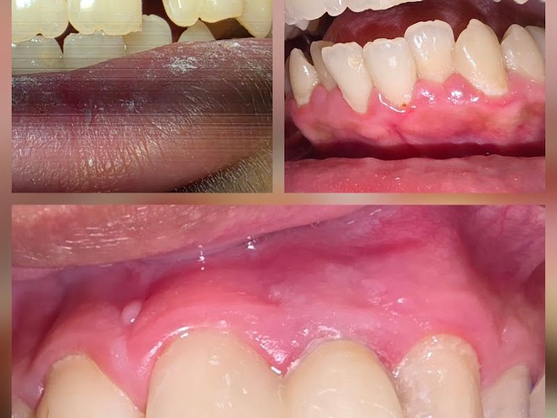 Gallery — SmileCraft Dentistry Clinic, Pimpri-Chinchwad