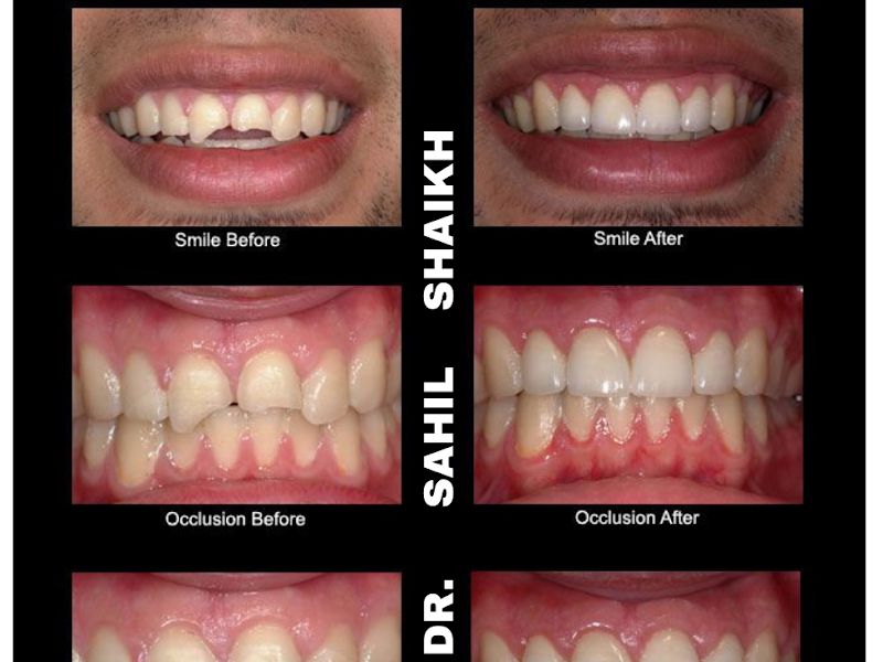 Gallery — Align Edge Dental Clinic & Orthodontic Center, Panvel
