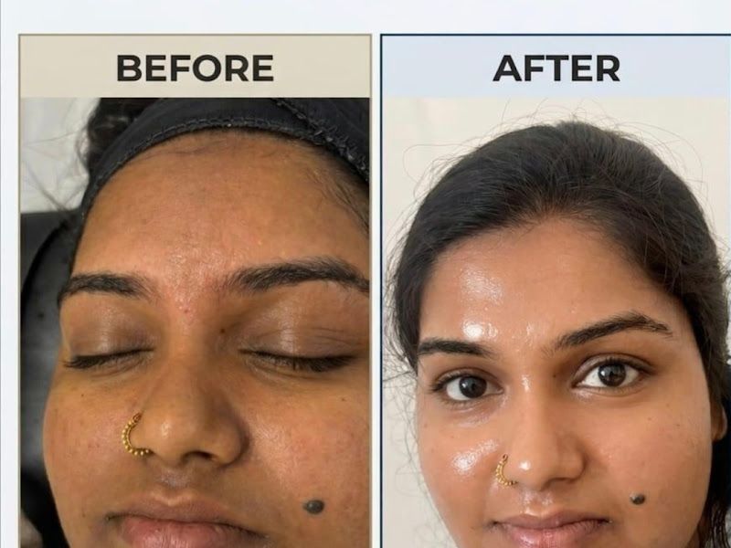 Gallery — Skin O Clock Skin Aesthetic Beauty Studio and Academy, Pune