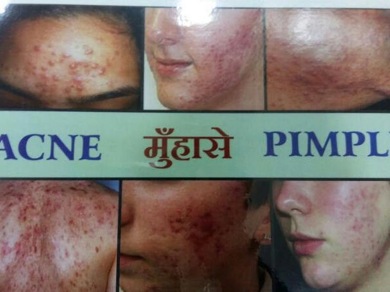 Gallery — Trishala Acupuncture Clinic — Dr. Dilipkumar R. Shah, Mumbai