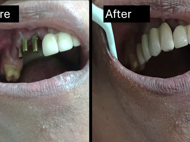 Gallery — Dr Pote's Dental Clinic, Dombivli East