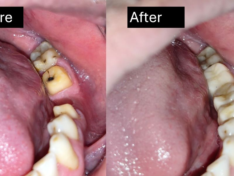 Gallery — Dr Pote's Dental Clinic, Dombivli East