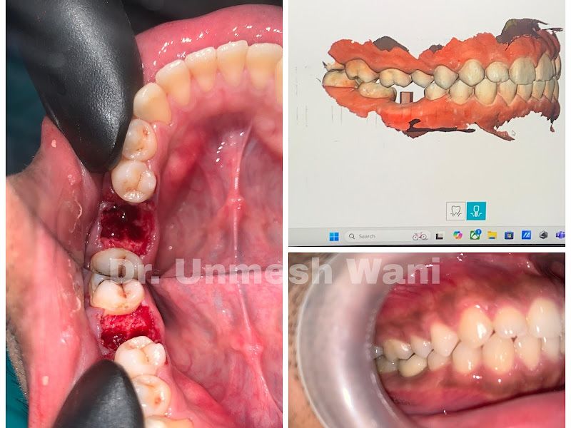 Gallery — Dr. Wani's Multispeciality Dental Clinic, Thane (West)