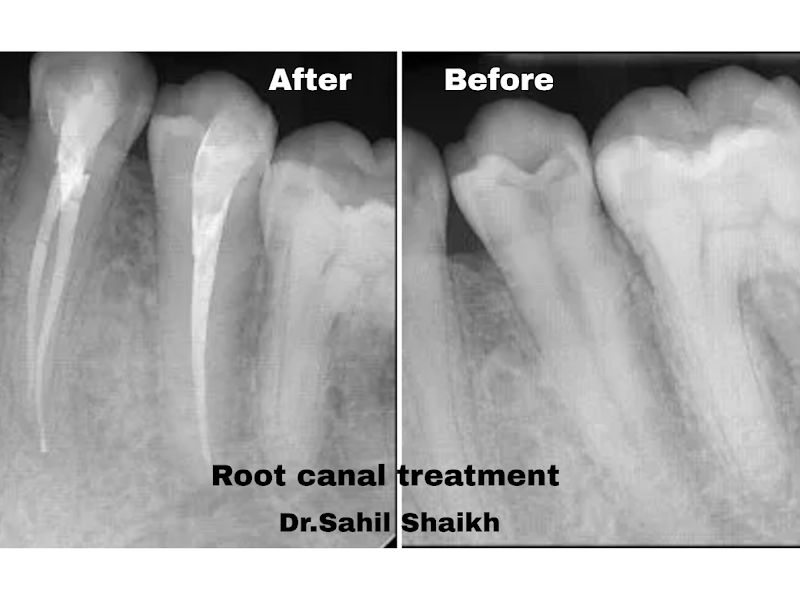 Gallery — Align Edge Dental Clinic & Orthodontic Center, Panvel