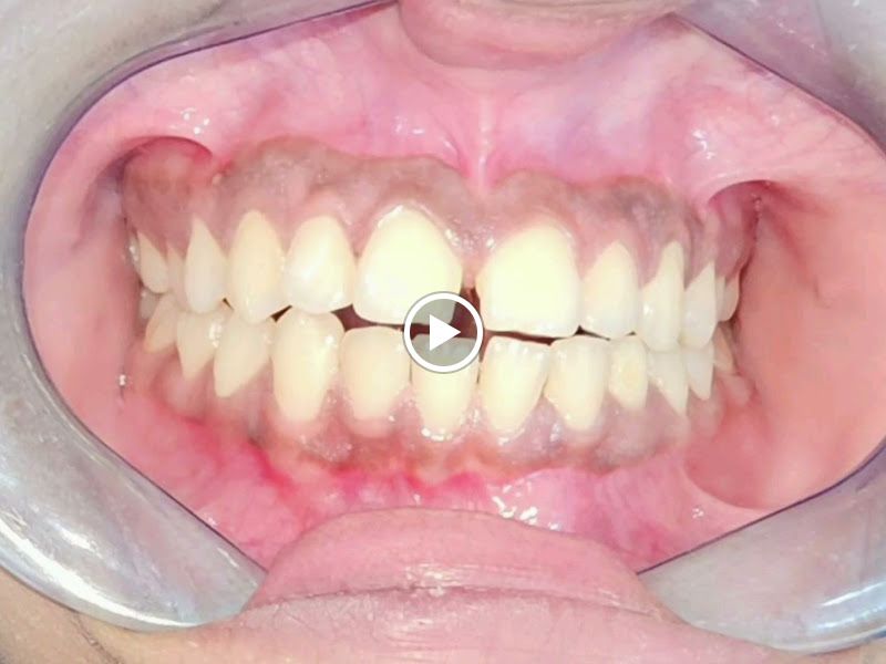 Gallery — House of Aligners, Mumbai