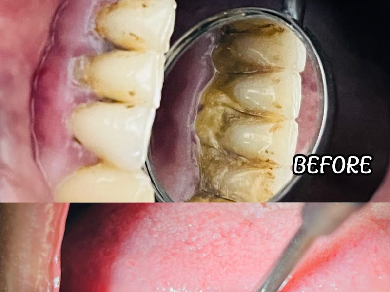 Gallery — Dr. Rachna's Dental Clinic, Pune