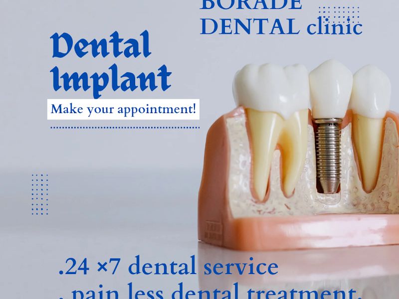 Gallery — Borade Dental Clinic, Pune