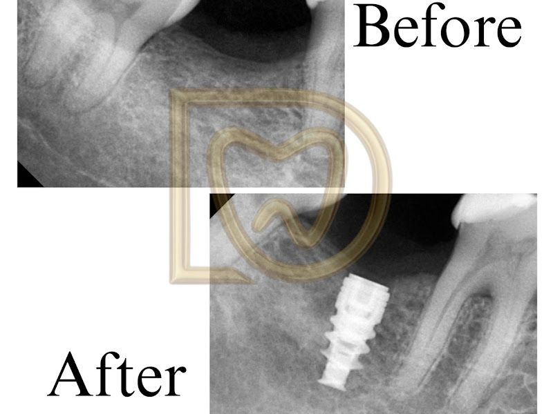 Gallery — Swami The Dental Studio, Kalyan