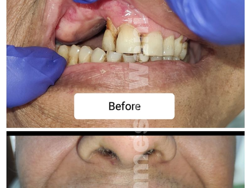 Gallery — Dr. Wani's Multispeciality Dental Clinic, Thane (West)