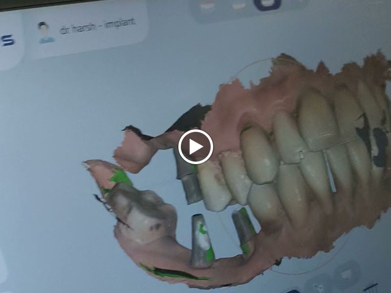 Gallery — Gajanan Dental Care, Thane