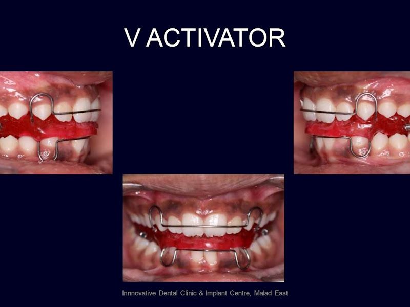 Gallery — Innovative Dental Clinic and Implant Centre, Mumbai