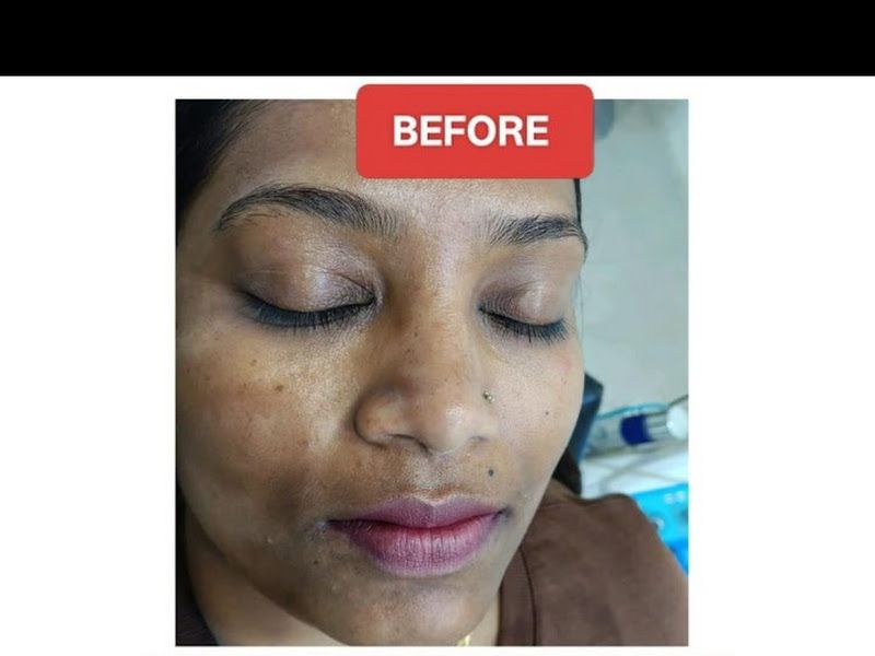 Gallery — Skin O Clock Skin Aesthetic Beauty Studio and Academy, Pune