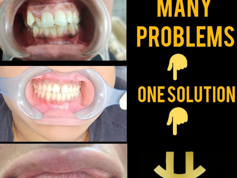 Gallery — House of Aligners, Mumbai