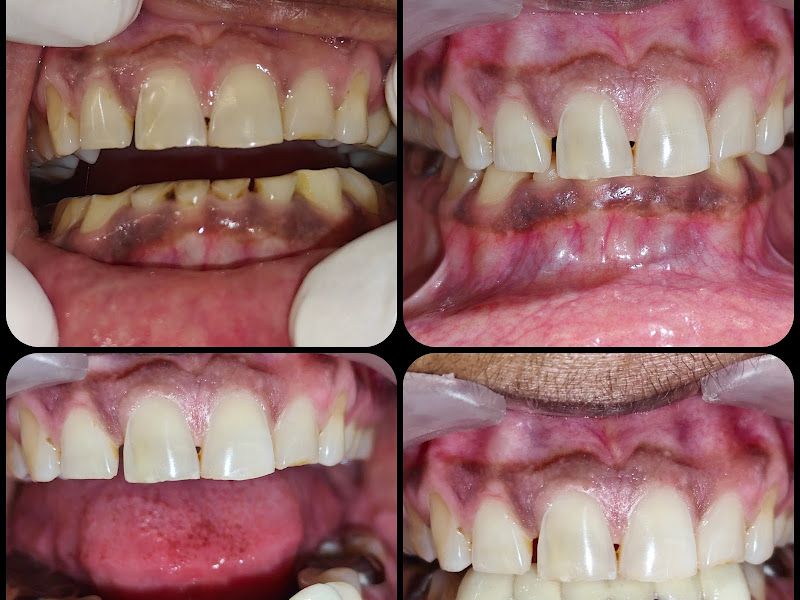 Gallery — Punamiya Dental Clinic, Akurdi