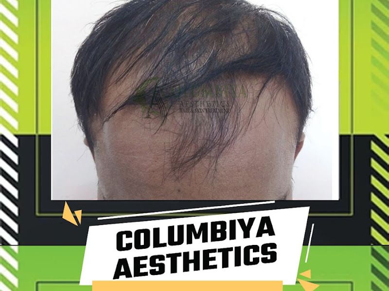Gallery — Columbiya Aesthetics, Pune