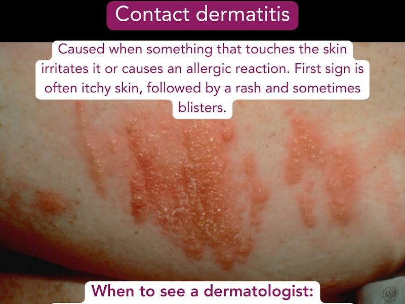 Gallery — Dr. Neeta's Bodysculpt Clinic, Nerul, Navimumbai