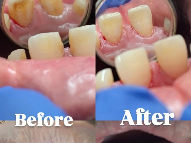 Gallery — Dr. Rachna's Dental Clinic, Pune