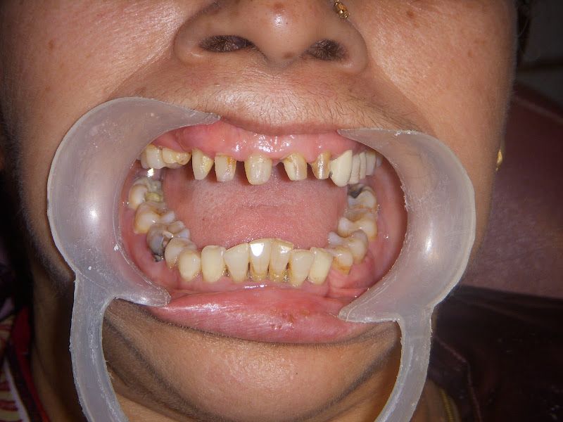 At work — Happy Teeth by Dr. Priyank Bajani, Mumbai