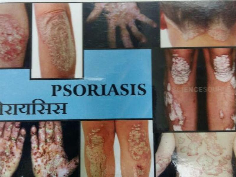 Gallery — Trishala Acupuncture Clinic — Dr. Dilipkumar R. Shah, Mumbai