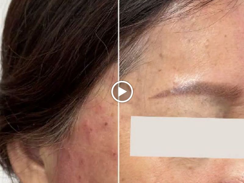 Gallery — Dr. Surbhi's Derma Aesthetic Clinic, Kalyan