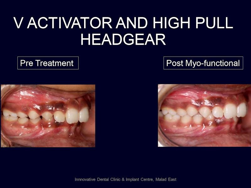 Gallery — Innovative Dental Clinic and Implant Centre, Mumbai