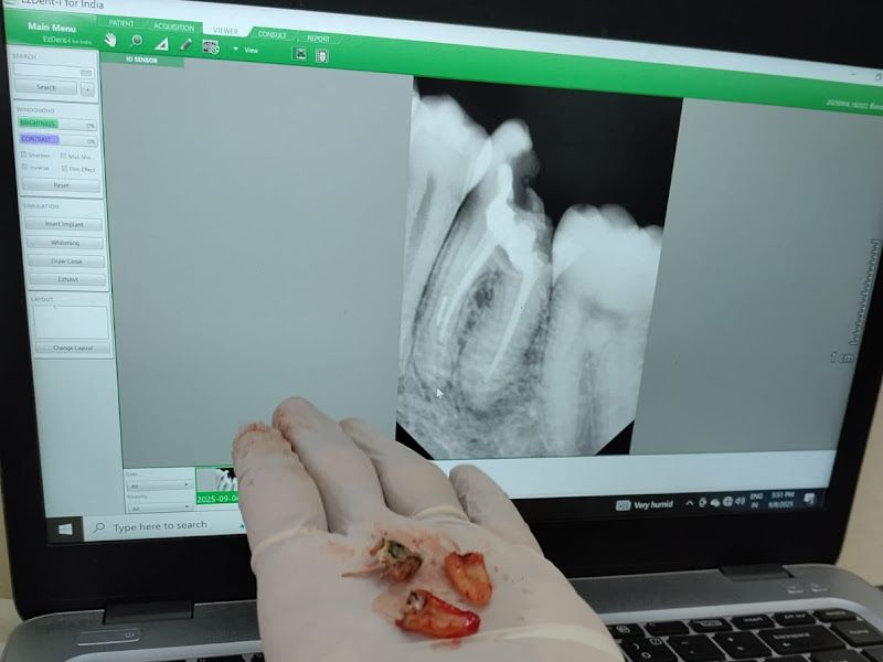 Gallery — Dr. Rachna's Dental Clinic, Pune