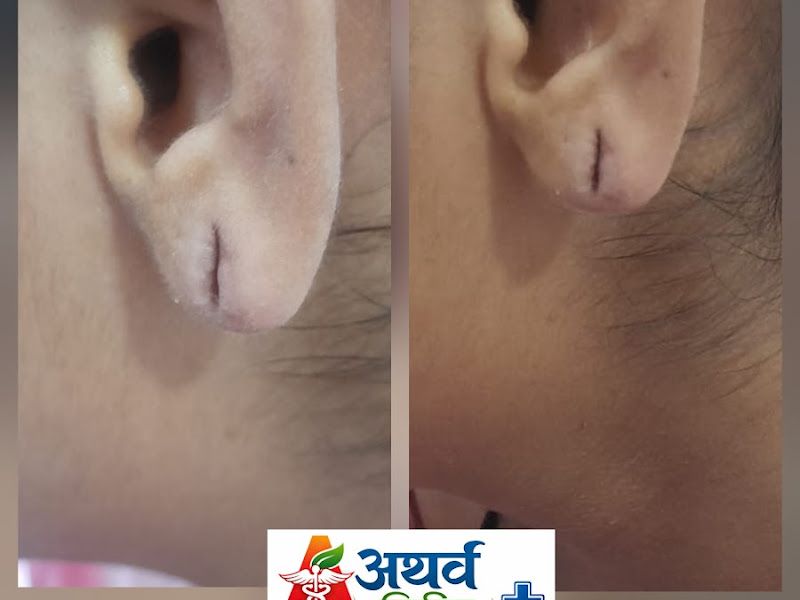 Gallery — Dr. Ganesh Avhad - Doctor Home Visit Service, Kalyan