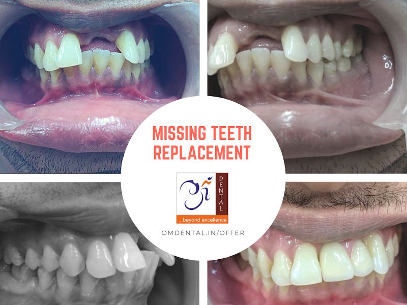 At work — Dr. Berani's Om Dental Clinic, Mumbai