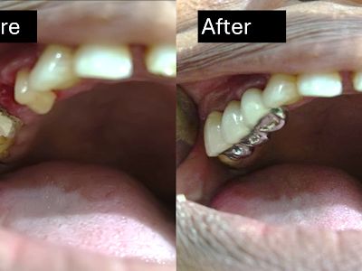 Dr Pote's Dental Clinic — Dental clinic in Dombivli East