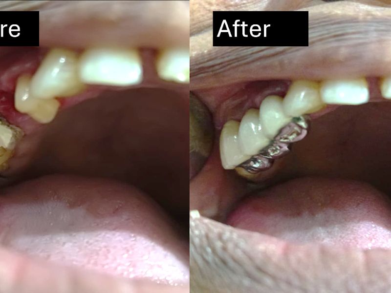 Gallery — Dr Pote's Dental Clinic, Dombivli East