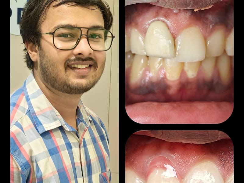 Gallery — Punamiya Dental Clinic l Dr. Ankit & Dr. Paryusha l Best Dental Clinic in PCMC l Dentist in Akurdi l Root Canal Specialist, Akurdi