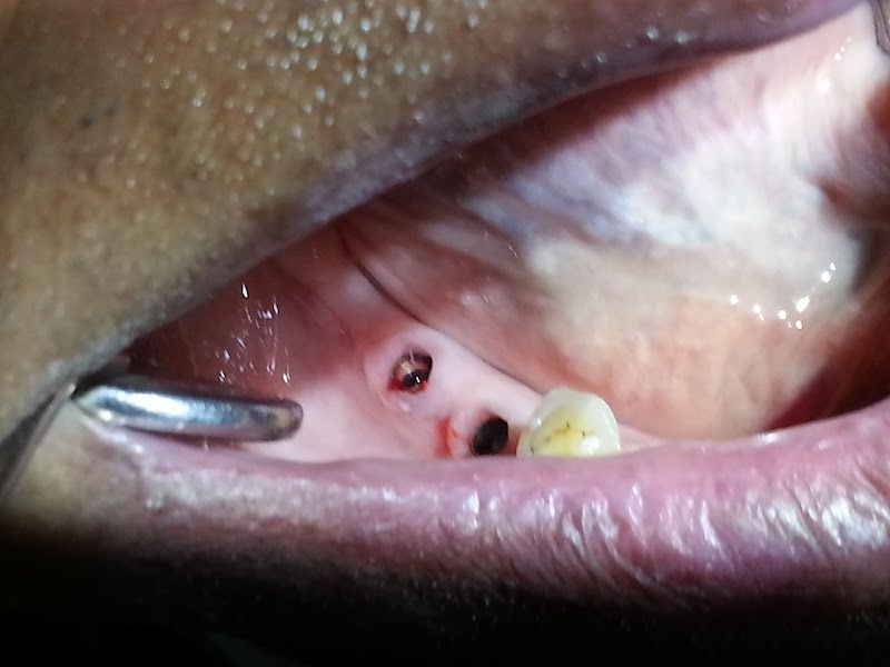 At work — Happy Teeth by Dr. Priyank Bajani, Mumbai