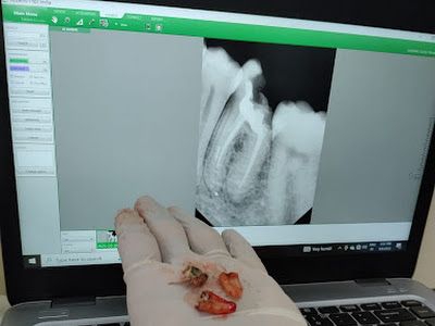 Dr. Rachna's Dental Clinic — Dentist in Pune