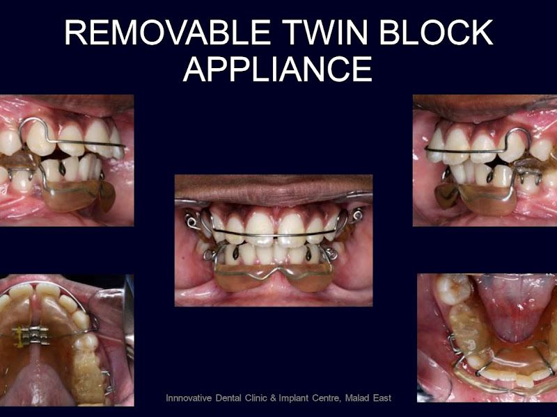 Gallery — Innovative Dental Clinic and Implant Centre, Mumbai