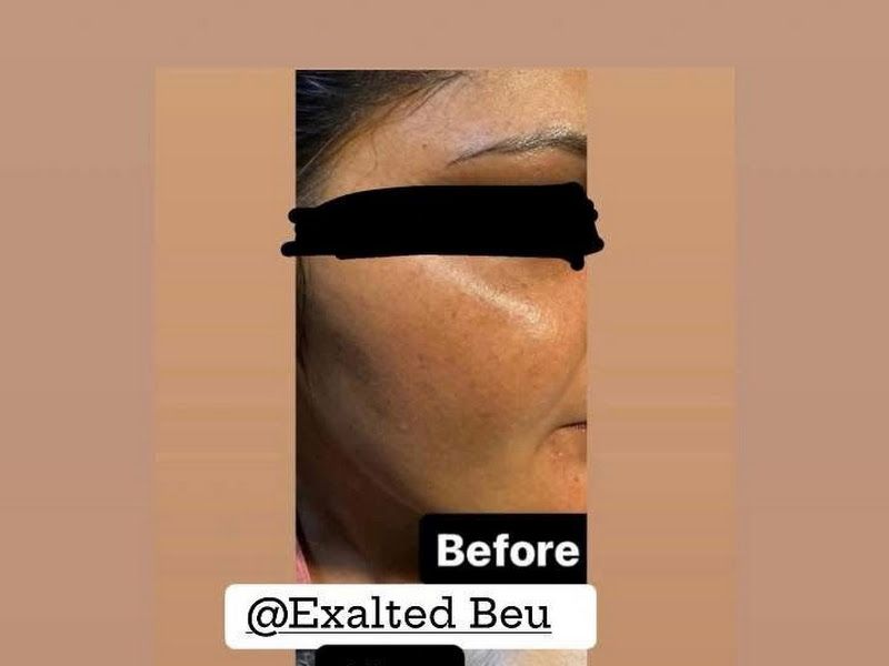 Owner-shared before & after — brighter, more even-toned 'glass skin' result after a skin-brightening course. — Exalted Beauty, Versova, Mumbai