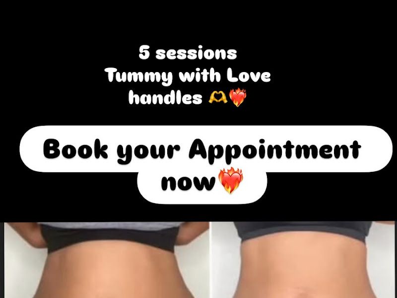 Owner-shared before & after — tummy and love-handle reduction over a five-session body-contouring course. — Exalted Beauty, Versova, Mumbai