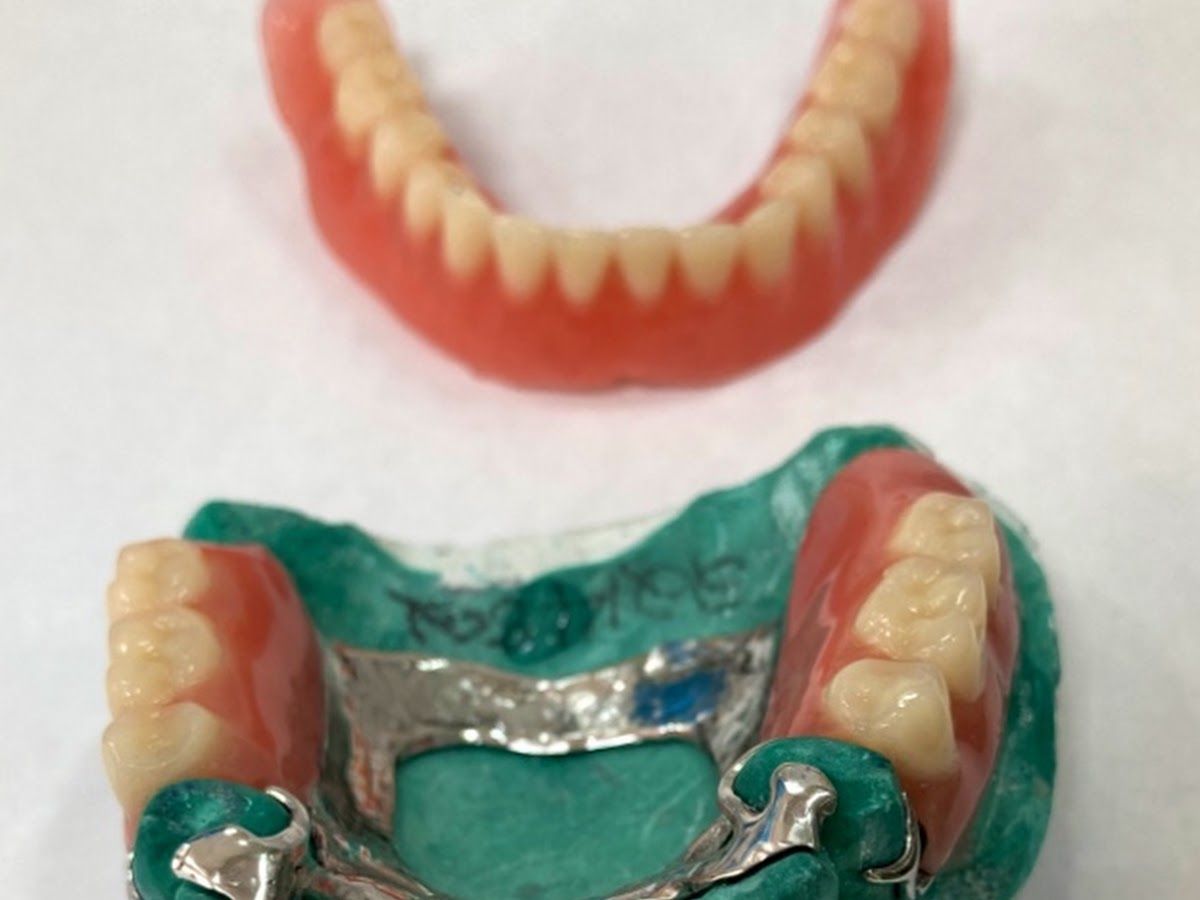Gallery — Advanced Dental Care Centre, Attur Layout, Bengaluru