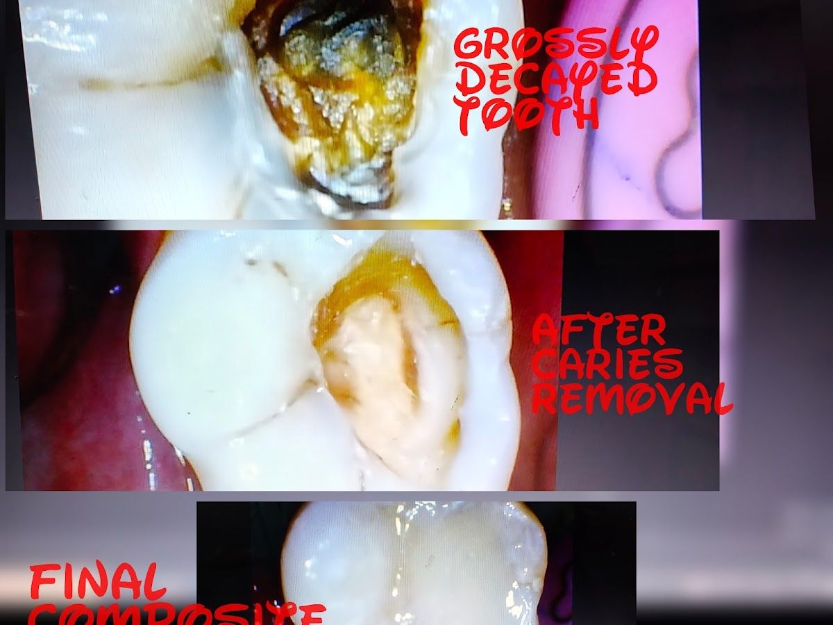 Gallery — Alwar Dental Hospital(Orthodontic & Implant centre), Paldi Meena, Jaipur