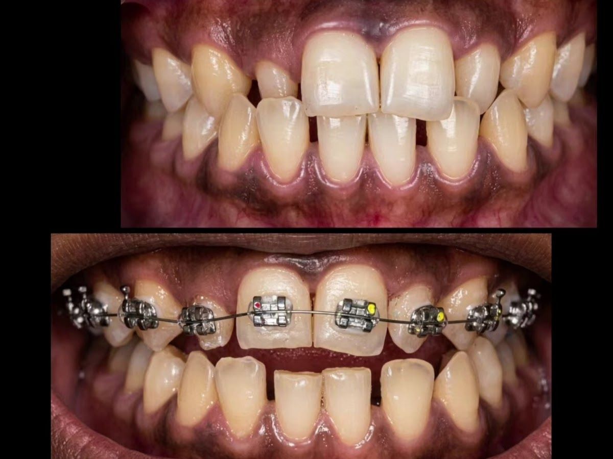 Gallery — Alwar Dental Hospital(Orthodontic & Implant centre), Paldi Meena, Jaipur
