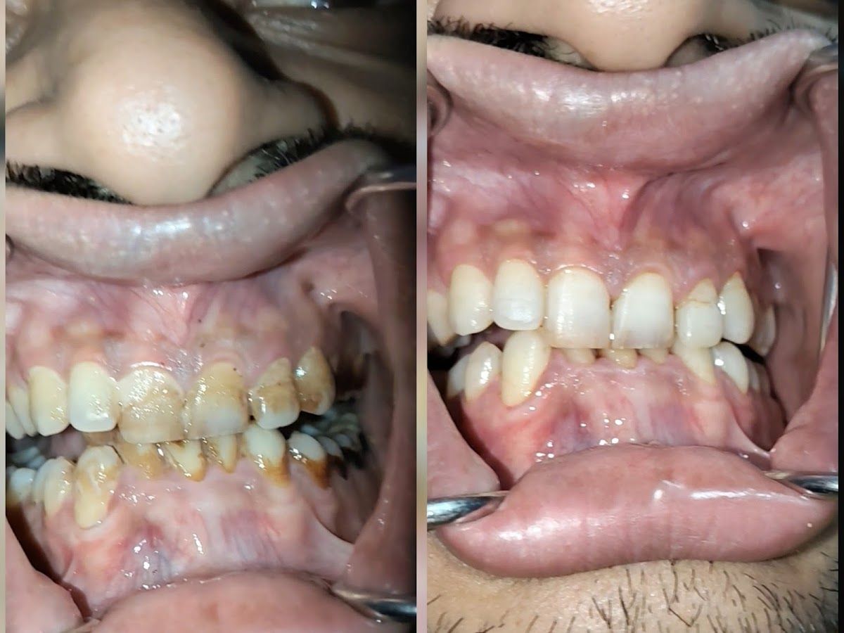 Gallery — Alwar Dental Hospital(Orthodontic & Implant centre), Paldi Meena, Jaipur