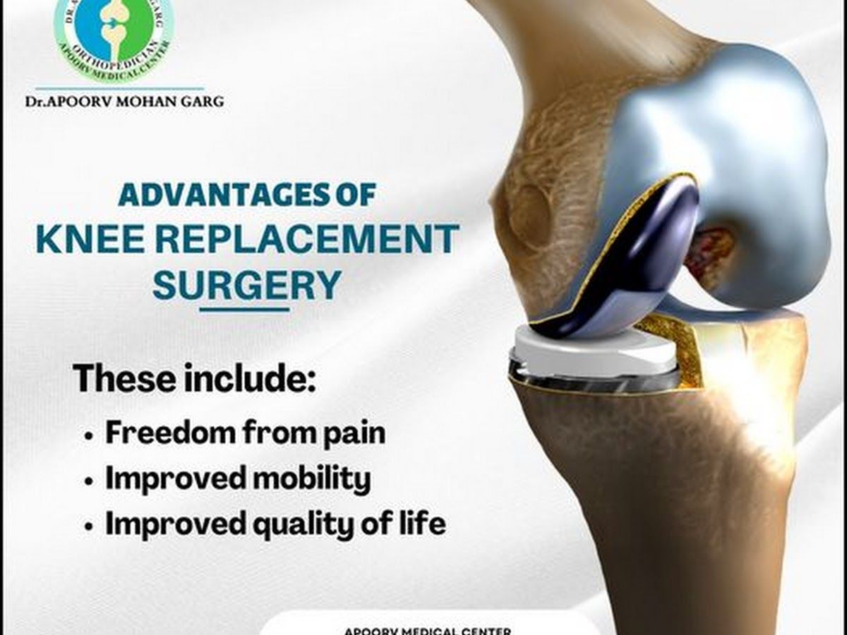 Gallery — Dr. Apoorv mohan garg Orthopaedic Clinic, Parikshitgarh