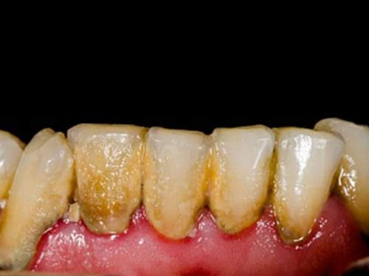 Gallery — Root Care Dental Clinic and Implant Centre, Channi Himat, Jammu